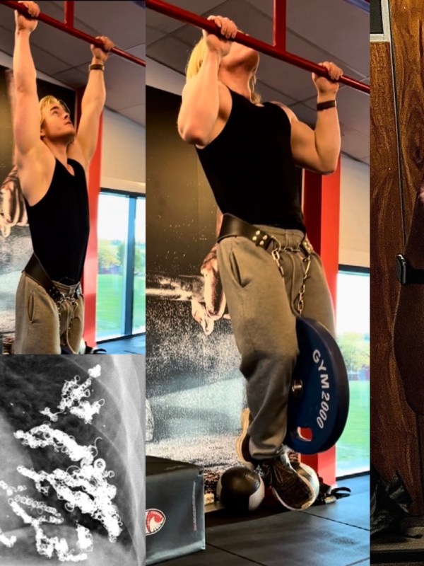 Voksen mot alle&nbsp;odds